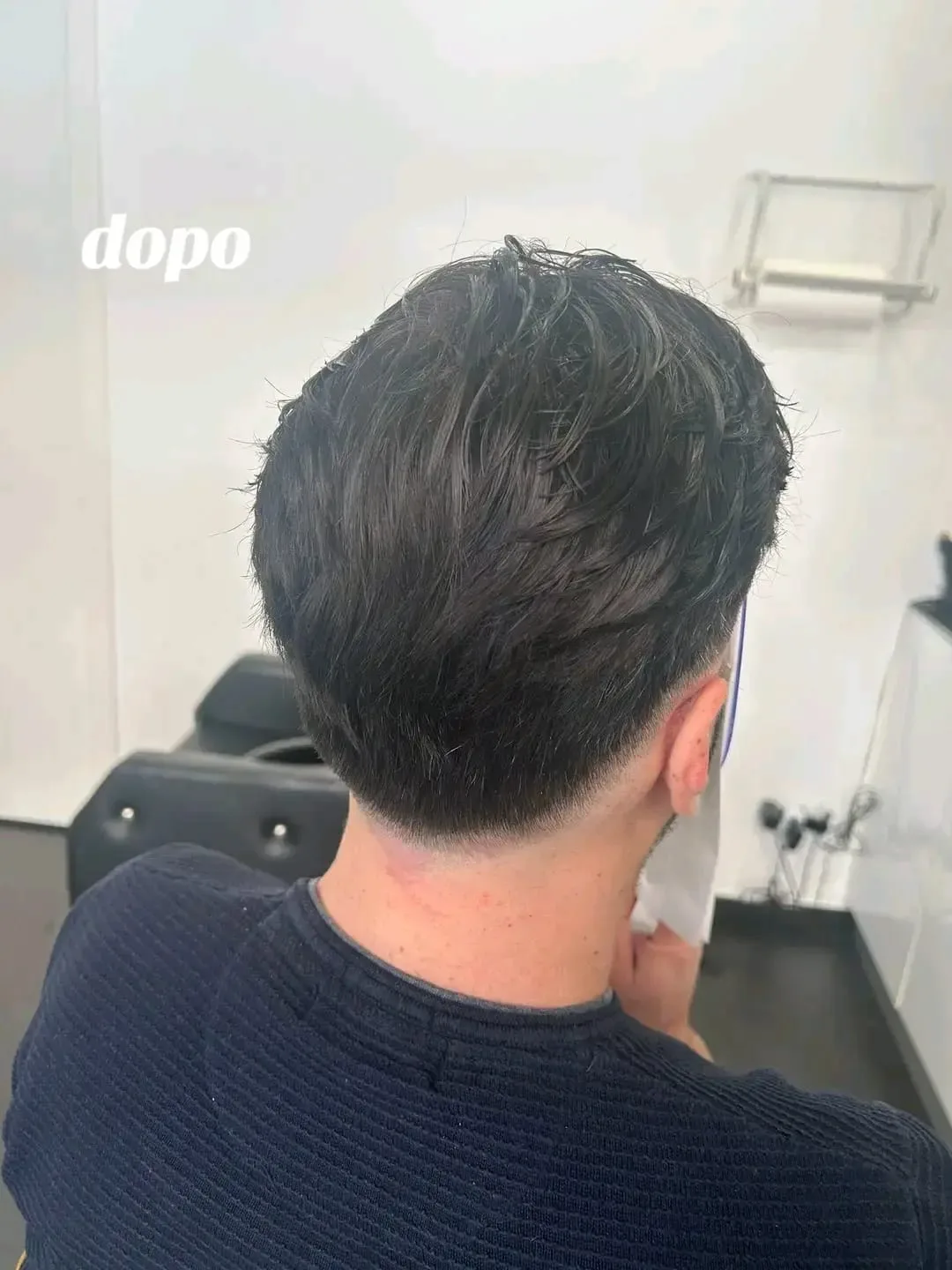 Dopo: capelli scuri e folti con la protesi capillare